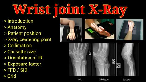 ap wrist|pa vs ap wrist xray.